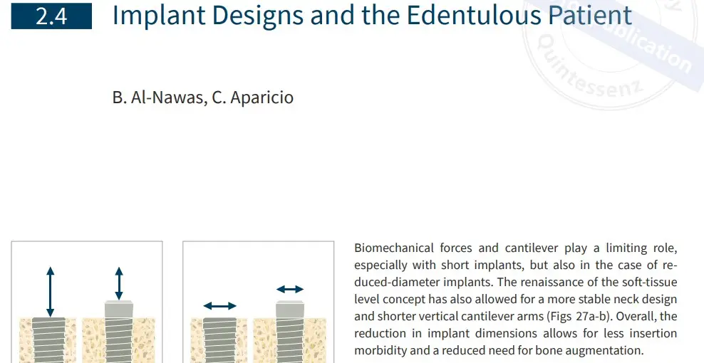 Implant designs article